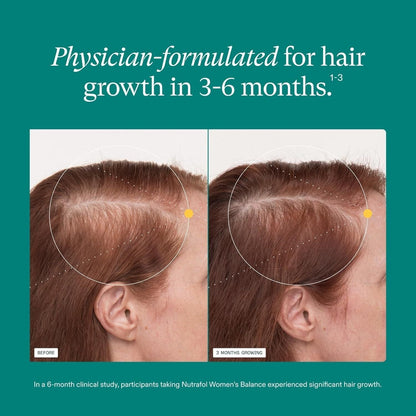Nutrafol Women's Balance Hair Growth Supplement